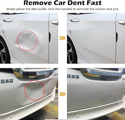 GripTech™ Dent Puller Pro