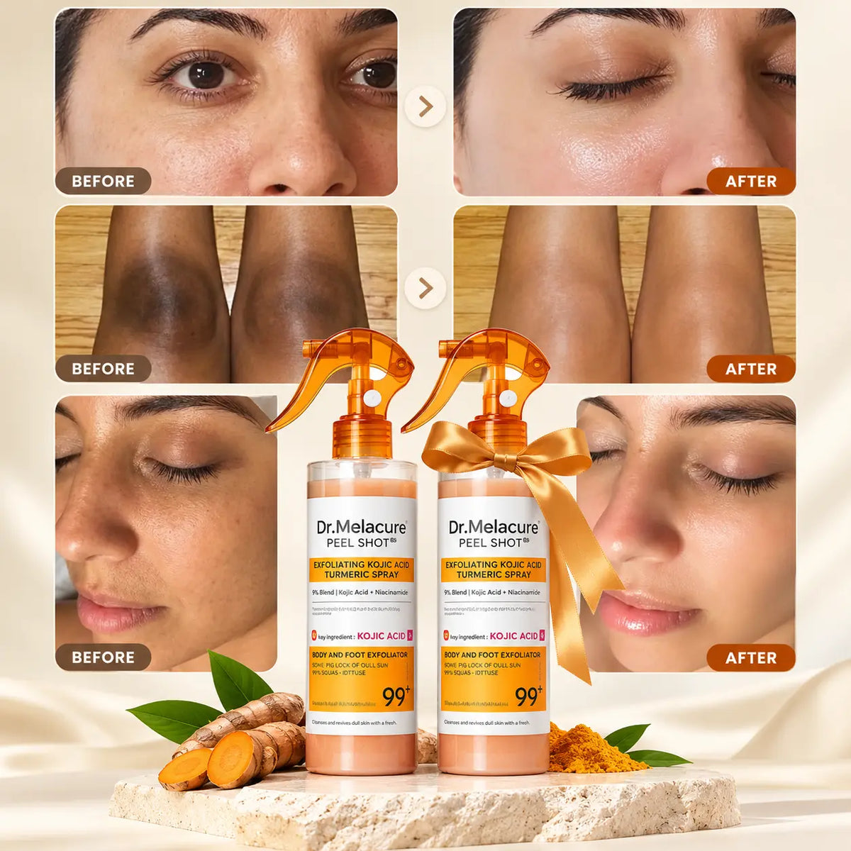 Dr. Melacure™ Full Body Kojic Acid & Turmeric Exfoliating Spray For Smooth & Clear Skin