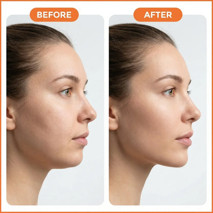 MyLifey™ Lymphatic Contour Face Brush