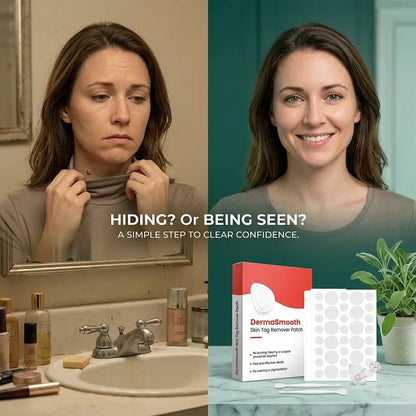 DermaSmooth™ – Skin Tag Remover for Gentle & Easy At-Home Removal